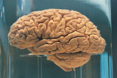 100 Brains Missing From University Of Texas At Austin