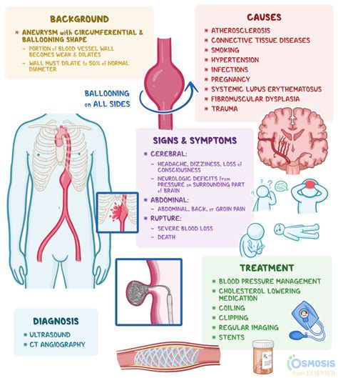 Fusiform Aneurysm What Is It Causes Treatment And More Osmosis