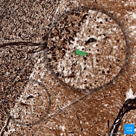 Histology of cerebellum histology slide of cerebellum histological slide of cerebellum histology cerebellum histology slide cerebellum slide slide of cerebellum normal histology of cerebellum histology of normal. Cerebellum: histology, layers, cell types and anatomy | Kenhub