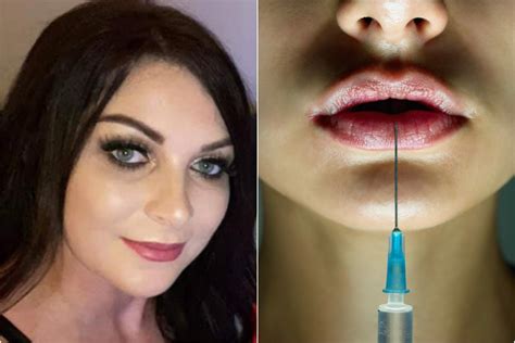 Scots Cop Faces Probe Into Claims She Got Lip Fillers And Botox While
