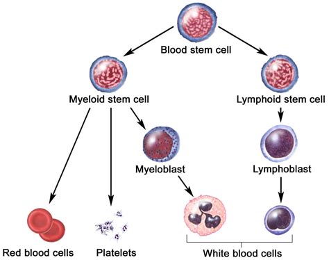 Myelogenous Leukemia Acute Chronic Symptoms Diagnosis And Treatment