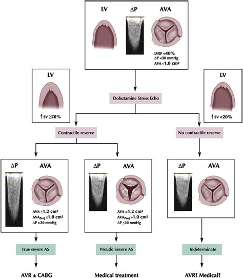 Aortic Stenosis Severity Criteria
