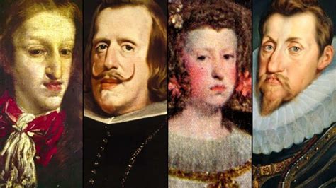 The Habsburg Jaw Can Be Attributed To Inbreeding
