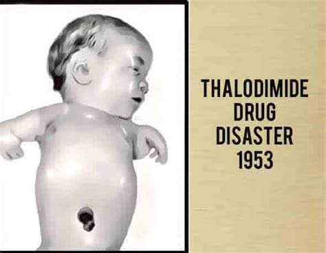 Thalidomide Drug Tragedy 1950s