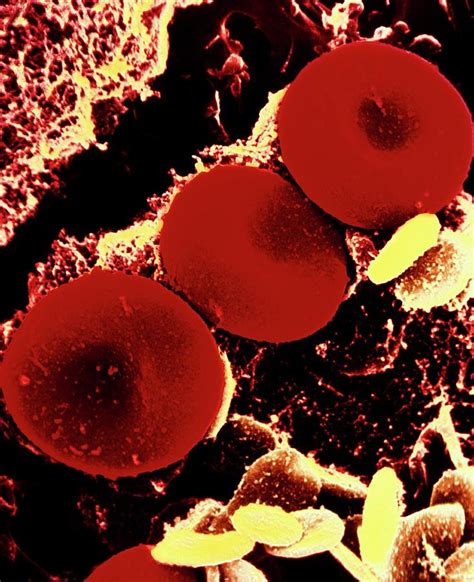 Coloured Sem Of 3 Human Red Blood Cells Photograph By Ab Dowsett