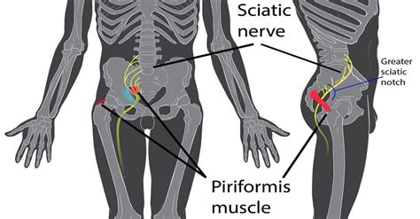 Since the all the back muscles originate in embryo (fetus) form by function: Pin on Pinched Nerve In Lower Back