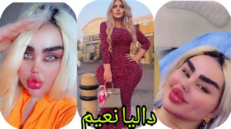 ان تصدق عيناك كيف صارت المذيعة العراقية داليا نعيم بعد عملية التجميل ممنوع دخول الاطفال وشكرا
