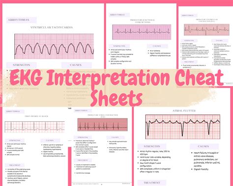 Ecg Interpretation Cheat Sheet What Exactly Is An Ecg An 41 Off
