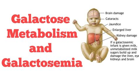 Galactose Metabolism Biochemistry Youtube
