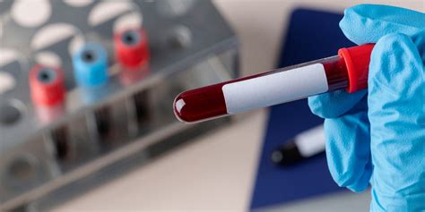 Blood Collection Tubes The Right Choice For Your Experiment