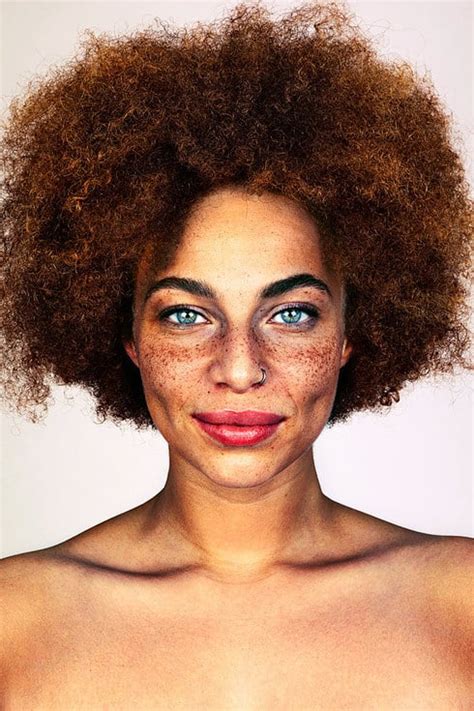 Photos Of People With Freckles Popsugar Beauty