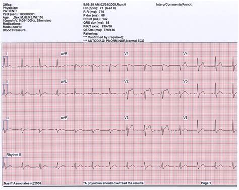 Automatic Diagnosis Of The 12 Lead Ecg Using A Deep Neural 55 Off