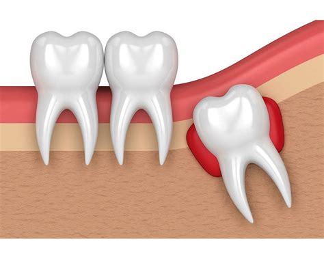 Simple Science: How to Make a Volcano with Kids