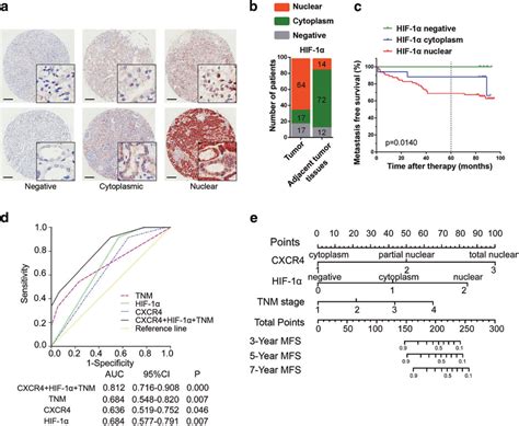 Extension Of The Tnm Stage Prognostic Model With Cxcr4 And Hif 1α