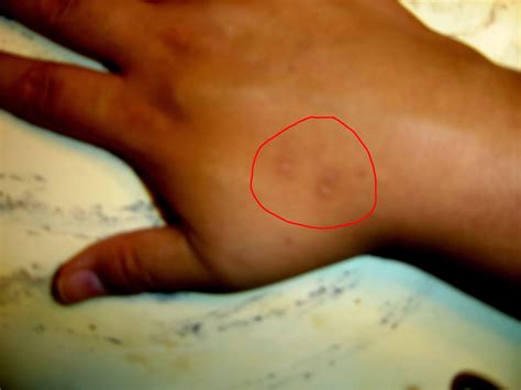 Alien abductions may be the taking of one person, or groups of people. UFOs and Alien Abductions in Los Angeles: Markings on my ...