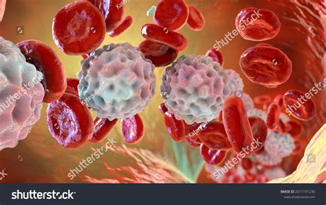 215 Leukocytosis Images Stock Photos And Vectors Shutterstock