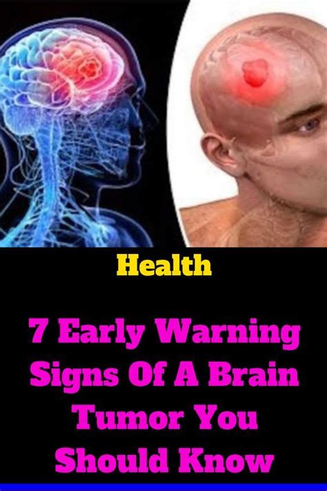 7 Early Warning Signs Of A Brain Tumor You Should Know Good Health