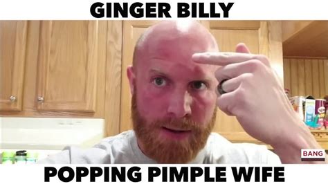 Ginger Billy Comedian Ginger Billy Popping Pimple Wife Lol Funny