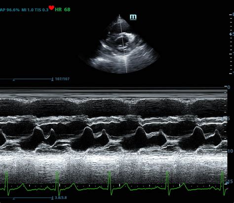 Cardiovascular Sonography