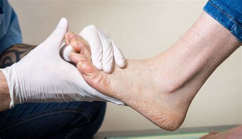 12 Easy Remedies To Help You Get Relief From Ankle Sprain
