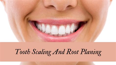 Tooth Scaling And Root Planing