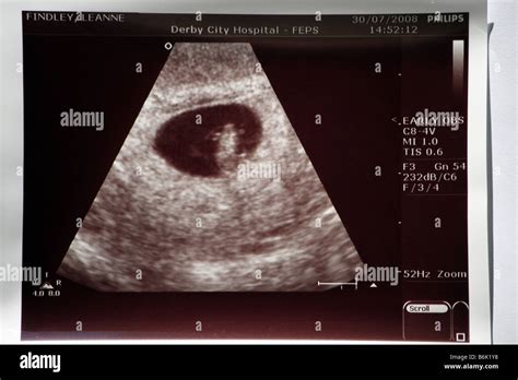 Barriga De 7 Semanas De Gestação Fotos