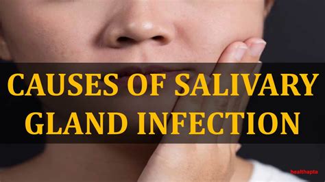Causes Of Salivary Gland Infection Youtube