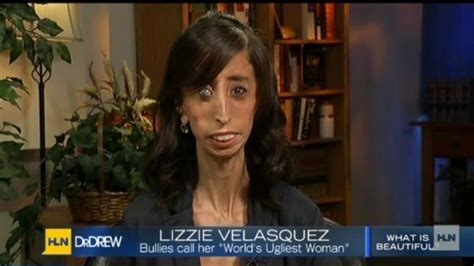 lizzie velasquez answers bullies who branded her the world s ugliest woman pictures