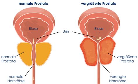 Robocoin.site die prostata oder vorsteherdrüse ist eine akzessorische geschlechtsdrüse aller männlichen wachstum und funktion der vorsteherdrüse werden. Sitoprostat® - Unterstützung von Prostata, Blase und der ...