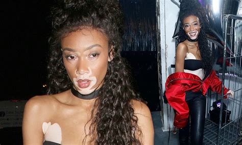 Winnie Harlow Confidently Flaunts Her Model Figure At Dazed Magazine Party