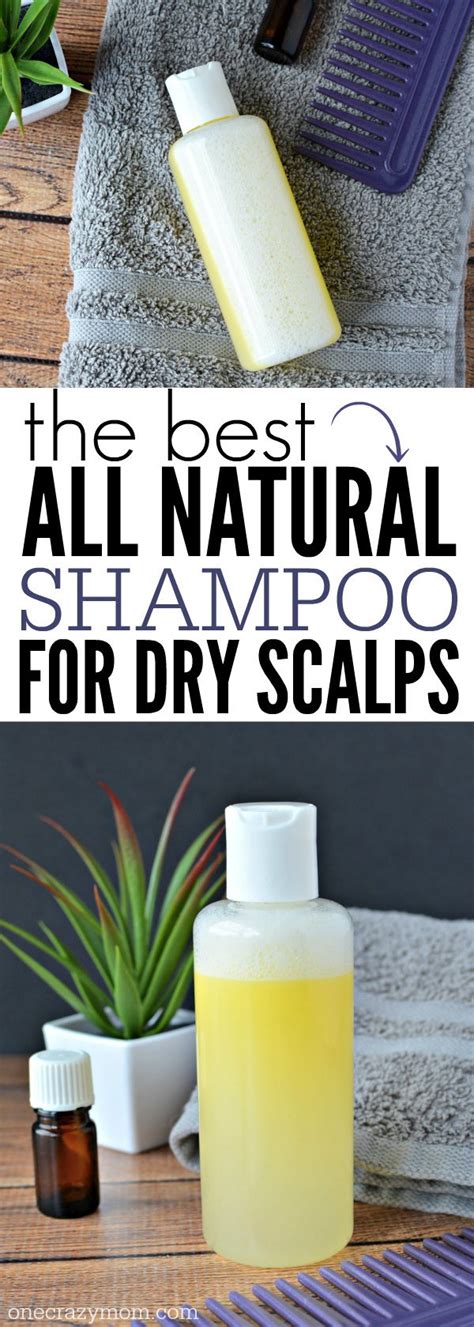 Best Natural Dandruff Shampoo Diy Dandruff Shampoo