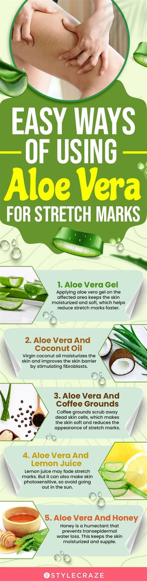 How To Use Aloe Vera To Treat Stretch Marks