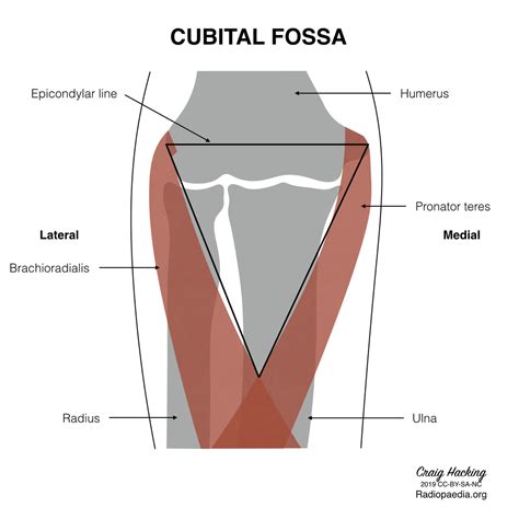 Cubital Fossa Diagram Radiology Case