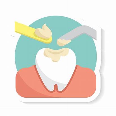Dental Fillings Filling Tooth Teeth Dentist Amalgam