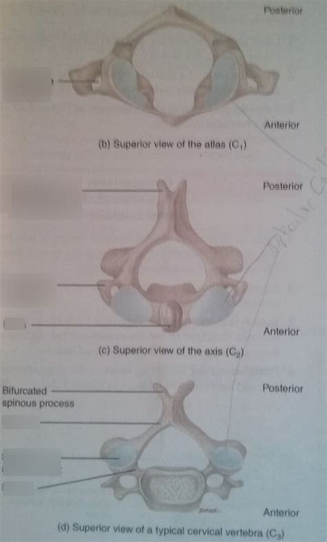 Cervical Vertebrae Atlas Axis And Normal Diagram Quizlet