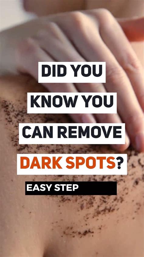 How To Fade Dark Spots Naturally Video How To Fade Fade Dark Spots