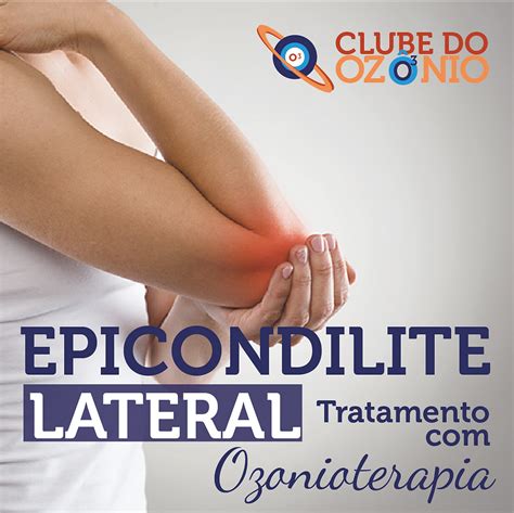 Epicondilite Lateral Cotovelo Do Tenista Tratamento Ozonioterapia