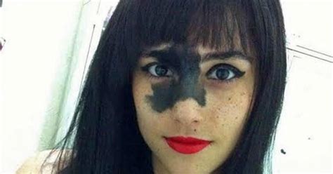 this girl s rare birthmark looks bizarre to people but she proved that it makes her standout