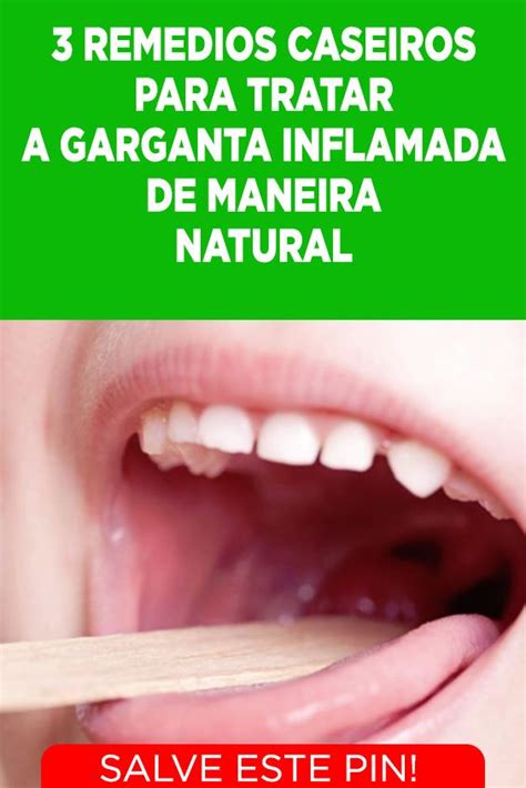 3 Remédios Caseiros Para Tratar A Garganta Inflamada De Maneira Natural