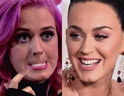 Katy Perry Plastic Surgery Before And After Boob Job Botox