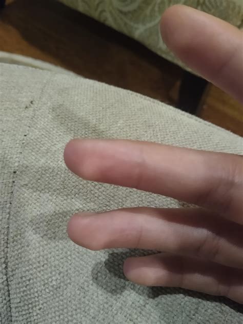 Hmm I Seem To Have Weird Looking Fingers There Are Bumps On My