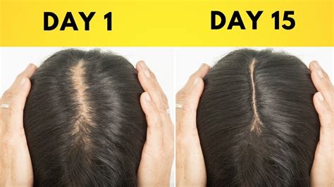 How To Grow Thicker Stronger Hair Naturally 9 Proven Ways To Get
