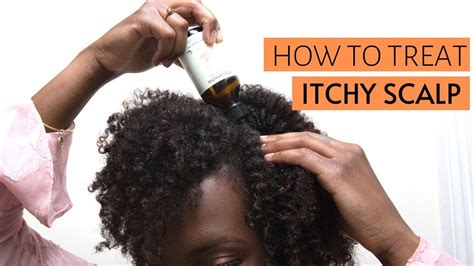 Deal With An Itchy Scalp Causes Remedy And Prevention In 2020 Dry