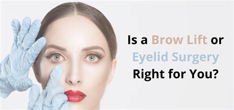Eyelid Surgery Or Blepharoplasty In Iran Costs And Recommendations