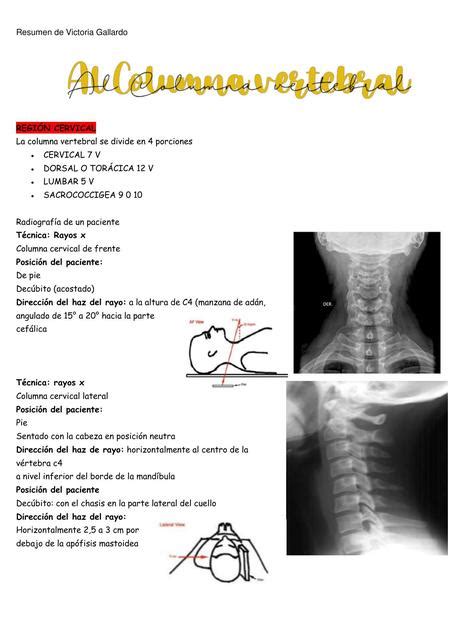 Diagnostico Por Im Genes Columna Vertebral Victoria Gallardo Udocz