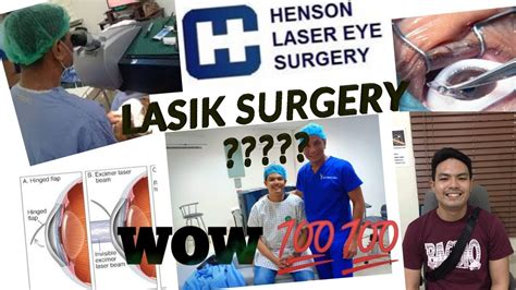 My Lasik Eye Surgery Experience Youtube