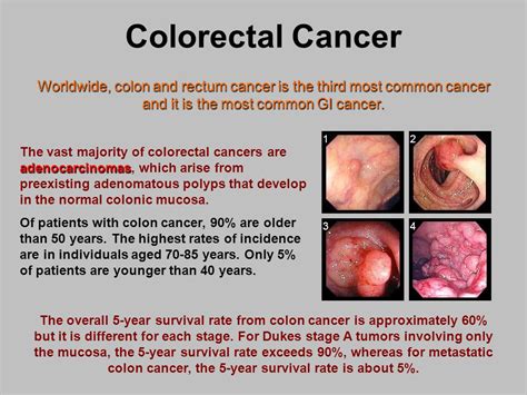 Radiation and chemo treatments are usually combined and are. JESSE MATTHEW HAS STAGE 4 COLON CANCER