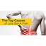 Schluter Chiropractic » The Top Causes Of Low Back Pain  Tulsa Chiropactor