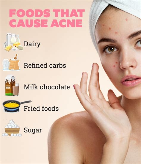 Acne Diet Homecare24