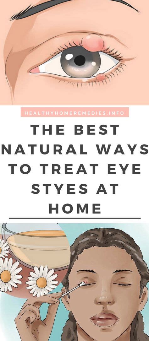 The Best Natural Ways To Treat Eye Styes At Home Healthy Home
